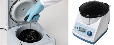 function of microcentrifuges|how microcentrifuge works.